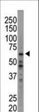 Western blot of anti-HRI antibody in A375 cell lysate. HRI (arrow) was detected using purified antibody. Secondary HRP-anti-rabbit was used for signal visualization with chemiluminescence.