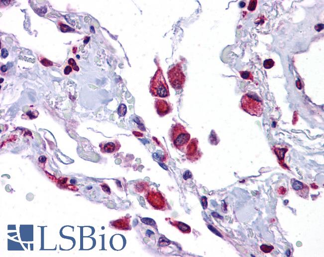Anti-EIF2AK1 antibody IHC of human lung. Immunohistochemistry of formalin-fixed, paraffin-embedded tissue after heat-induced antigen retrieval. Antibody LS-B4656 concentration 5 ug/ml.