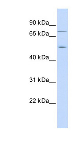 EIF2AK1 antibody LS-B4656 Western blot of Fetal Lung lysate.
