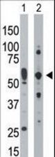 The anti-PRKR antibody is used in Western blot to detect PRKR in mouse uterus tissue lysate (Lane 1) and HepG2 cell lysate (Lane 2).