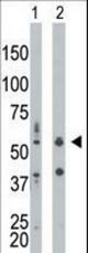 The anti-PRKR antibody is used in Western blot to detect PRKR in mouse liver tissue lysate (Lane 1) and HepG2 cell lysate (Lane 2).