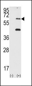 Western blot of EIF2AK2 (arrow) using PRKR Antibody. 293 cell lysates (2 ug/lane) either nontransfected (Lane 1) or transiently transfected with the EIF2AK2 gene (Lane 2) (Origene Technologies).