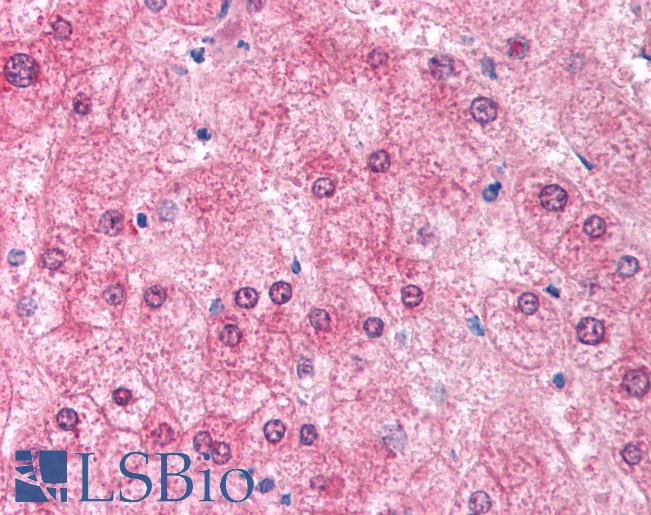 Anti-EIF2AK2 antibody IHC of human liver. Immunohistochemistry of formalin-fixed, paraffin-embedded tissue after heat-induced antigen retrieval. Antibody LS-B1352 concentration 5 ug/ml.