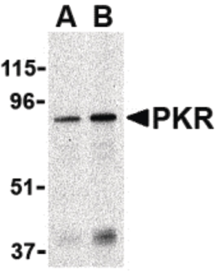 Western blot of PKR in Caco-2 whole cell lysate with PKR antibody at (A) 1 and (B) 2 ug/ml.