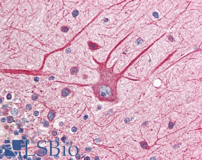Anti-EIF2AK2 antibody IHC of human brain, cerebellum. Immunohistochemistry of formalin-fixed, paraffin-embedded tissue after heat-induced antigen retrieval. Antibody LS-B563 concentration 5 ug/ml.