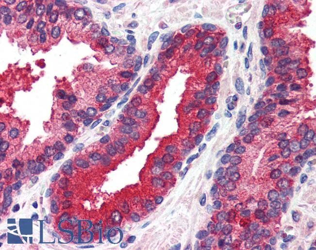 Anti-EIF2AK2 antibody IHC of human prostate. Immunohistochemistry of formalin-fixed, paraffin-embedded tissue after heat-induced antigen retrieval. Antibody LS-B563 concentration 5 ug/ml.