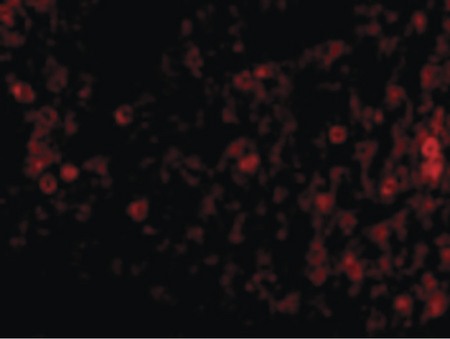 Immunofluorescence of PKR in Rat Lung cells with PKR antibody at 20 ug/ml.