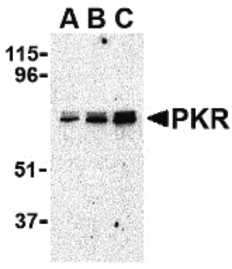 Western blot of PKR in A431 whole cell lysate with PKR antibody at (A) 0.5, (B) 1 and (C) 2 ug/ml.