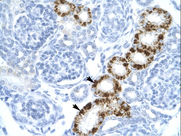 EIF2AK2 antibody LS-C29859 was used in IHC to stain formalin-fixed, paraffin-embedded human kidney.