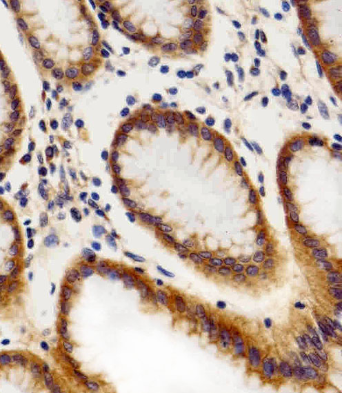 Immunohistochemical of paraffin-embedded H. stomach section using CHML Antibody. Antibody was diluted at 1:100 dilution. A peroxidase-conjugated goat anti-rabbit IgG at 1:400 dilution was used as the secondary antibody, followed by DAB staining.