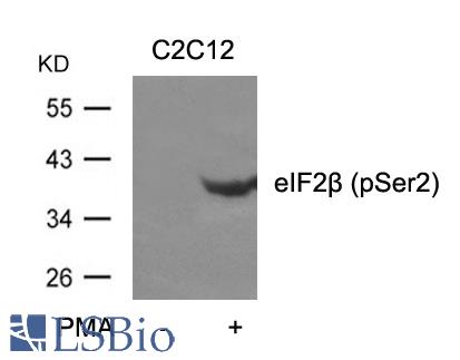 Western blot of extracts from C2C12 cells untreated or treated with PMA using eIF2b (phospho-Ser2) antibody.