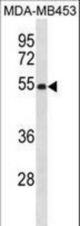 EIF2S2 Antibody western blot of MDA-MB453 cell line lysates (35 ug/lane). The EIF2S2 antibody detected the EIF2S2 protein (arrow).
