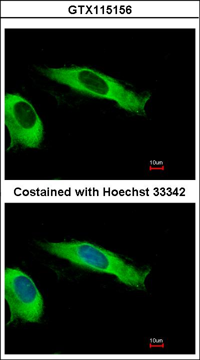 Immunofluorescence of methanol-fixed HeLa, using EIF2 beta antibody at 1:500 dilution.