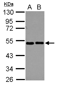 Sample (30 ug of whole cell lysate) A: A549 B: HeLa 10% SDS PAGE EIF2S2 antibody diluted at 1:10000