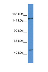 EIF3A antibody LS-C145469 Western blot of HeLa Cell lysate. Antibody concentration 1 ug/ml.