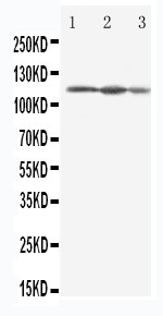 WB of EIF3B antibody. Lane 1: HELA Cell Lysate. Lane 2: 293T Cell Lysate. Lane 3: A431 Cell Lysate..
