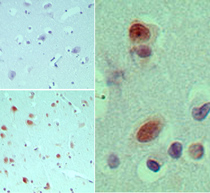 IHC ofeIF3G in formalin-fixed, paraffin-embedded human brain tissue using an isotype control (top left) and LS-C148508 (bottom left, right) at5 ug/ml.