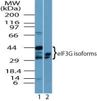 Western blot of eIF3G isoforms in 1) HeLa cell lysate and 2) RAW cell lysate using LS-C148508 at 4.0 ug/ml.