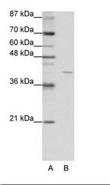 A: Marker, B: HepG2 Cell Lysate