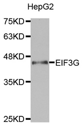 Western blot analysis of extracts of HepG2 cell lines, using EIF3G antibody.