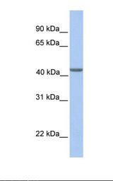 Fetal muscle lysate. Antibody concentration: 1.0 ug/ml. Gel concentration: 12%.