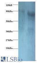 Western blot of Eukaryotic translation initiation factor 3, subunit 2 beta antibody at 2 ug/ml. Lane 1: EC109whole cell lysate. Lane 2: 293T whole cell lysate. Secondary: Goat polyclonal to Rabbit IgG at 1:15000 dilution. Predicted band size: 36 kDa. Observed band size: 80 kDa.