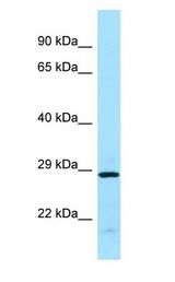 EIF3J antibody Western Blot of MCF7 cell lysate. EIF3J is strongly supported by BioGPS gene expression data to be expressed in Human MCF7 cells.