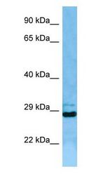 EIF3J antibody Western Blot of Jurkat cell lysate. EIF3J is strongly supported by BioGPS gene expression data to be expressed in Human Jurkat cells.