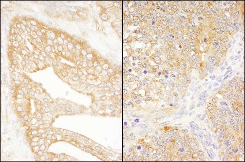 Detection of Human and Mouse eIF3J/EIF3S1 by Immunohistochemistry. Sample: FFPE section of human prostate carcinoma (left) and mouse teratoma (right). Antibody: Affinity purified rabbit anti-eIF3J/EIF3S1 used at a dilution of 1:1000 (1 Detection: DAB.