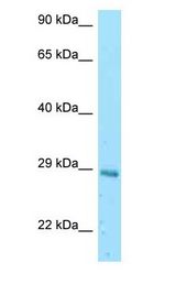 EIF3K antibody Western Blot of Mouse Liver.
