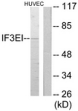 Western blot of extracts from HUVEC cells, using IF3EI Antibody. The lane on the right is treated with the synthesized peptide.
