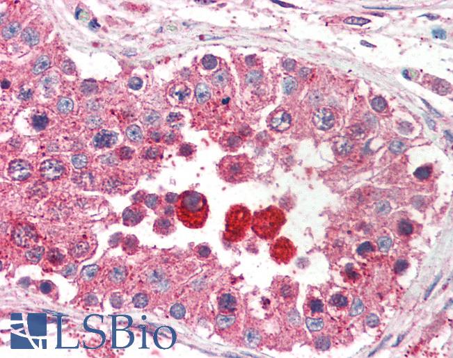 Anti-EIF3M / PCID1 antibody IHC of human testis. Immunohistochemistry of formalin-fixed, paraffin-embedded tissue after heat-induced antigen retrieval. Antibody LS-B2296 concentration 5 ug/ml.