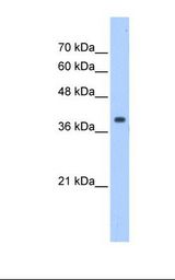 HepG2 cell lysate. Antibody concentration: 1.25 ug/ml. Gel concentration: 12%.