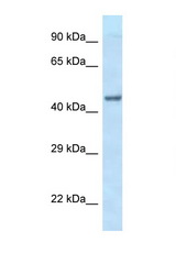 EIF3F antibody LS-C145579 Western blot of Fetal Heart lysate. Antibody concentration 1 ug/ml.