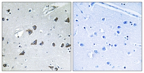 IHC of paraffin-embedded human brain tissue, using EIF3F Antibody. The picture on the right is treated with the synthesized peptide.