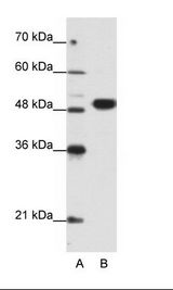 A: Marker, B: Jurkat Cell Lysate