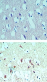 IHC ofeIF4A2 in paraffin-embedded formalin-fixed human brain tissue using an isotype control (top) and LS-C148457 (bottom) at 5 ug/ml.