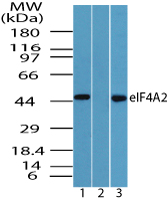 Western blot of eIF4A2 in human liver lysate in the 1) absence and2) presence of immunizing peptide and 3) mouse liver lysate using LS-C148457 at 0.5 ug/ml.