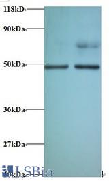 Western blot of Eukaryotic initiation factor 4A-II antibody at 2 ug/ml. Lane 1: EC109 whole cell lysate. Lane 2: 293T whole cell lysate. Secondary: Goat polyclonal to Rabbit IgG at 1:15000 dilution. Predicted band size: 44.8 kDa. Observed band size: 44.8 kDa Additional bands at: 70 kDa. We are unsure as to the identity of these extra band.