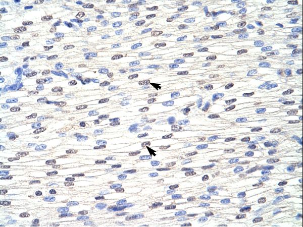 EIF4B antibody LS-C31324 was used in IHC to stain formalin-fixed, paraffin-embedded human heart.