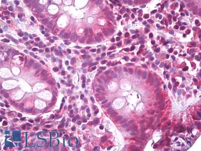 Anti-EIF4B antibody IHC of human colon. Immunohistochemistry of formalin-fixed, paraffin-embedded tissue after heat-induced antigen retrieval. Antibody LS-B7776 dilution 10 ug/ml.