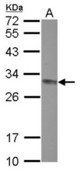 Sample (30 ug of whole cell lysate) A: Jurkat 12% SDS PAGE CLPP antibody diluted at 1:1000