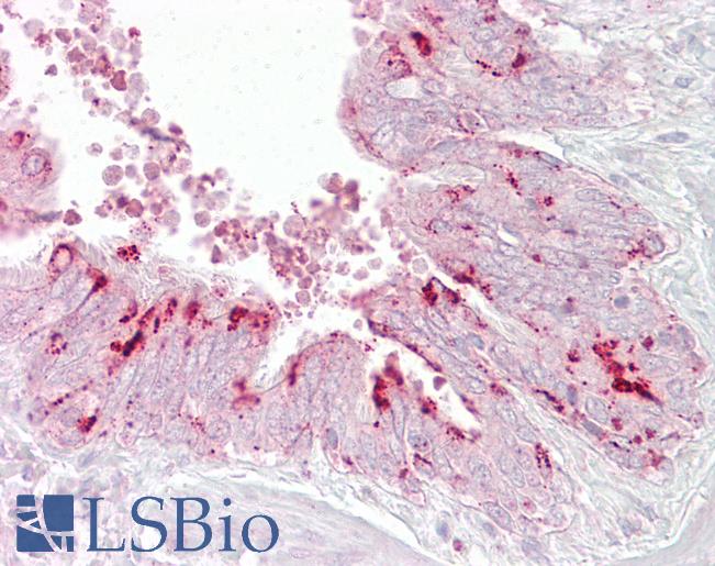 Anti-EIF4E antibody IHC of human lung, respiratory epithelium. Immunohistochemistry of formalin-fixed, paraffin-embedded tissue after heat-induced antigen retrieval. Antibody LS-B6817 concentration 5 ug/ml.