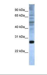 Fetal brain lysate. Antibody concentration: 1.0 ug/ml. Gel concentration: 12%.