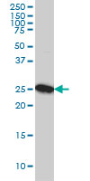CLPP monoclonal antibody (M01), clone 3E2 Western blot of CLPP expression in A-431.