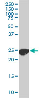 CLPP monoclonal antibody (M01), clone 3E2. Western blot of CLPP expression in PC-12.