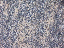 IHC of paraffin-embedded Human lymphoma tissue using anti-EIF4E2 mouse monoclonal antibody. (Heat-induced epitope retrieval by 10mM citric buffer, pH6.0, 100C for 10min).
