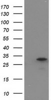 HEK293T cells were transfected with the pCMV6-ENTRY control (Left lane) or pCMV6-ENTRY EIF4E2 (Right lane) cDNA for 48 hrs and lysed. Equivalent amounts of cell lysates (5 ug per lane) were separated by SDS-PAGE and immunoblotted with anti-EIF4E2.