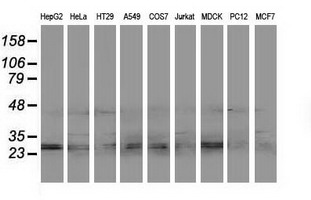 Western blot of extracts (35ug) from 9 different cell lines by using anti-EIF4E2 monoclonal antibody.