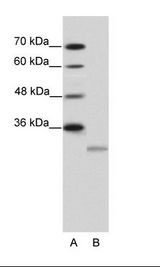 A: Marker, B: HepG2 Cell Lysate